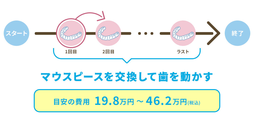 矯正の費用の目安を説明する図